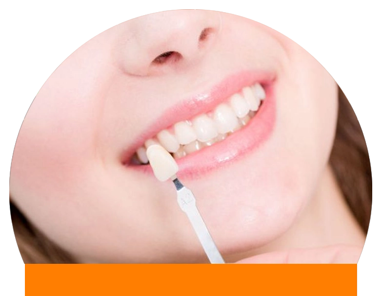 c03-dkt-lentes-de-contato-clinica-cora-balneario-camboriu Facetas de porcelana no Espaço Cora o seu dentista em Balneário Camboriú